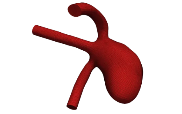 Aneurysm_service