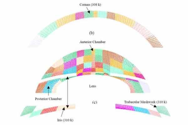 Human Eye Simulations with Grid Pros CFD Meshing Software
